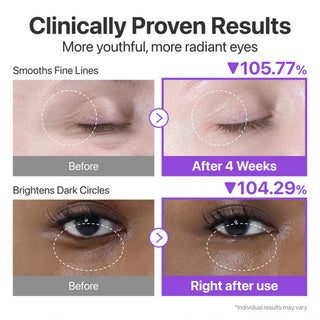 Numbuzin No.9 NAD+ Retinol Volumetox Eye Cream